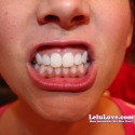 VIEW PHOTOS SET: Eating With Mouth/Throat Closeups
